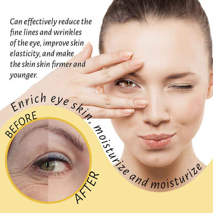 Hoygi Eye Ball Essence Oil Moisturizes And Moisturizes Eye Skin, Lightening Fine Lines And Softening Eye Area Essence Oil