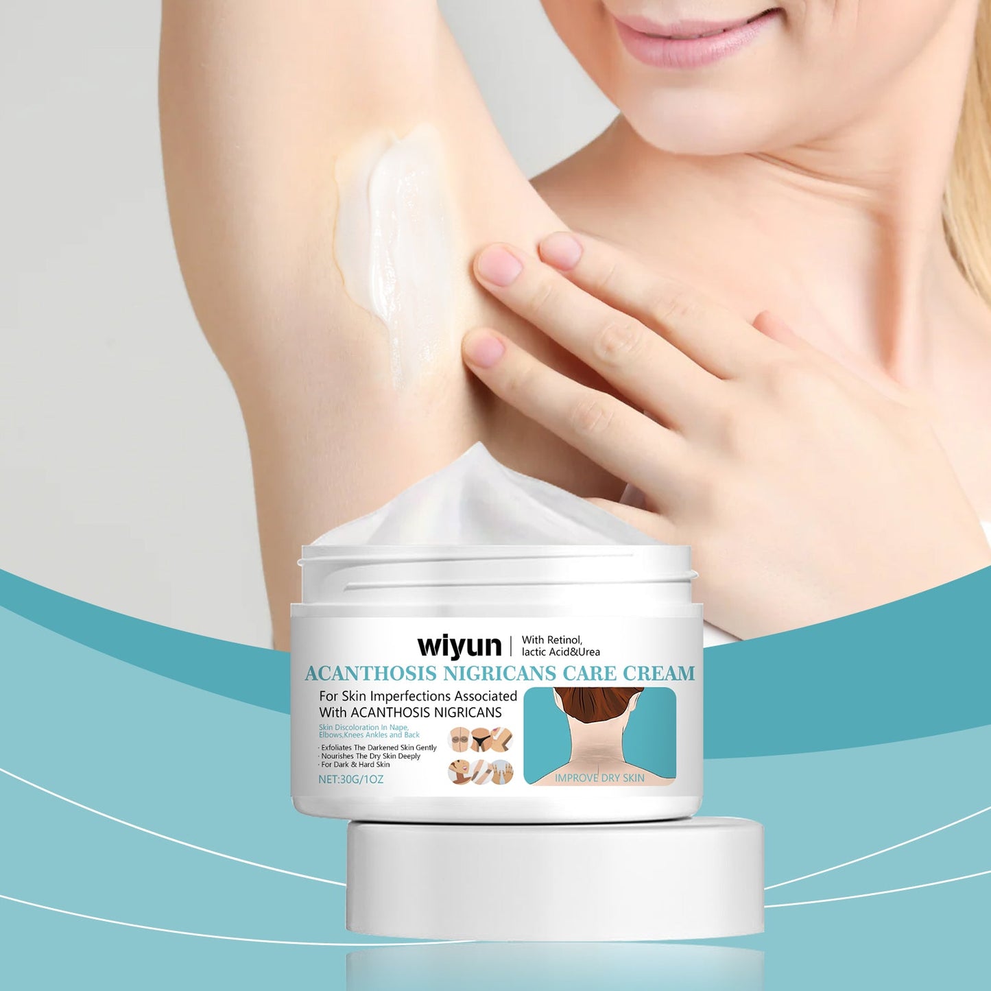 Wiyun Acanthoderma Nigricans Care Cream Soft Moist, Hydrating, Refreshing And Improving Dry And Tender Skin Body Care Cream