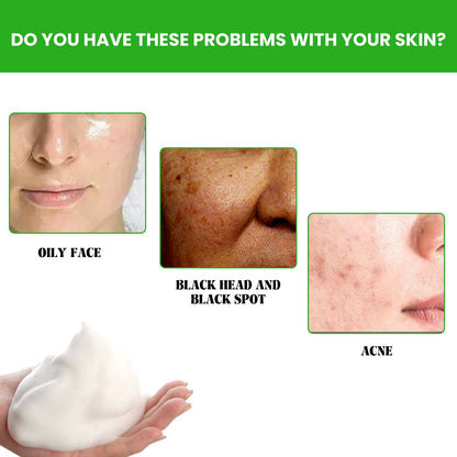 EELHOE Anti Acne Facial Wash, Deep Clean Oil Dirt Blackhead Acne Shrink Pores Refreshing And Comfortable