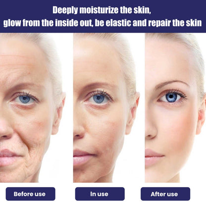 OUHOE Moisturizing Cream, Reduce Dark Spots And Fine Lines, Moisturize Firm Skin Care Cream