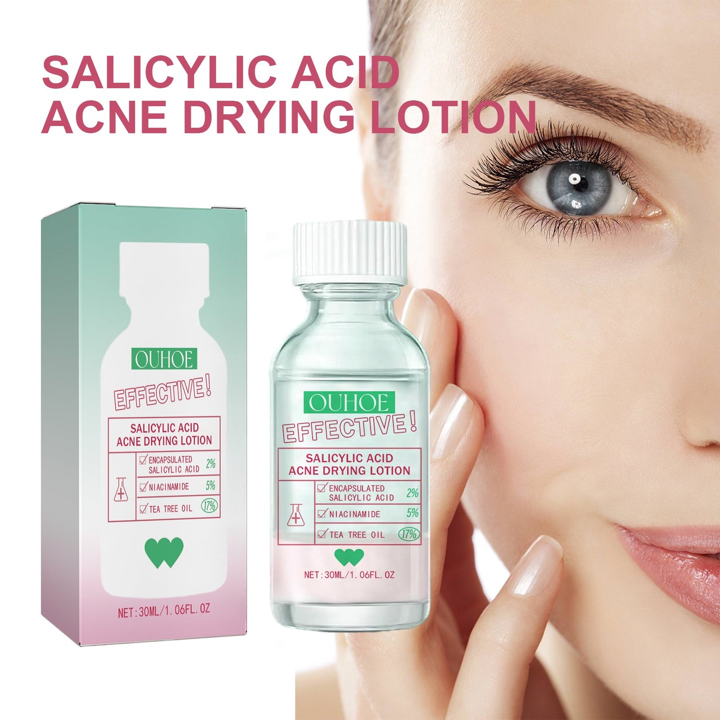 OUHOE Salicylic Acid Acne Lotion Gently Cares For Acne-Prone Skin, Refines Pores And Moisturizes Facial Skin