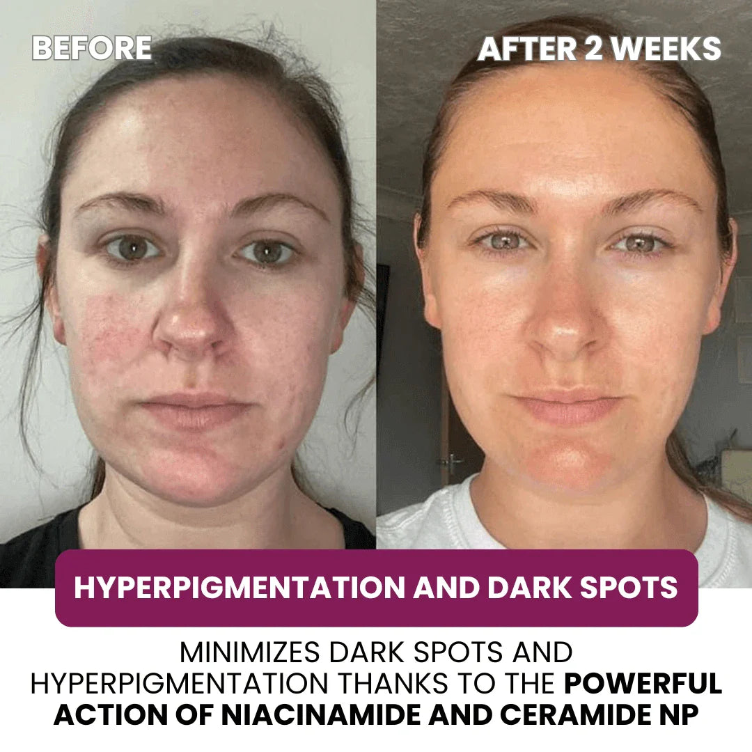 Hydrolyzed Collagen Age Defying Mask - 2.54 fl.oz