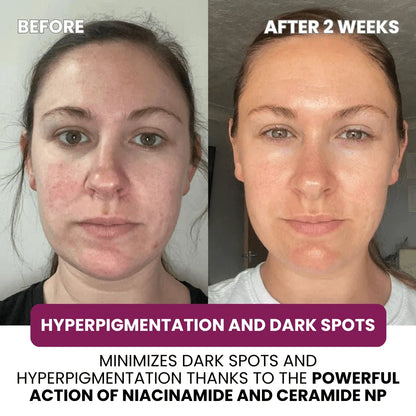 Hydrolyzed Collagen Age Defying Mask - 2.54 fl.oz