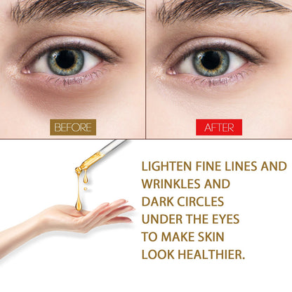 EELHOE Anti-Aging Eye Serum, Eye Bags, Pores, Eyes, Fine Lines And Dark Circles Care Essence
