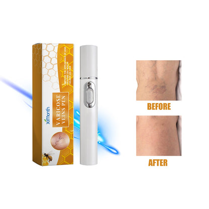 Leg Soothing Laser Pen 1pcs
