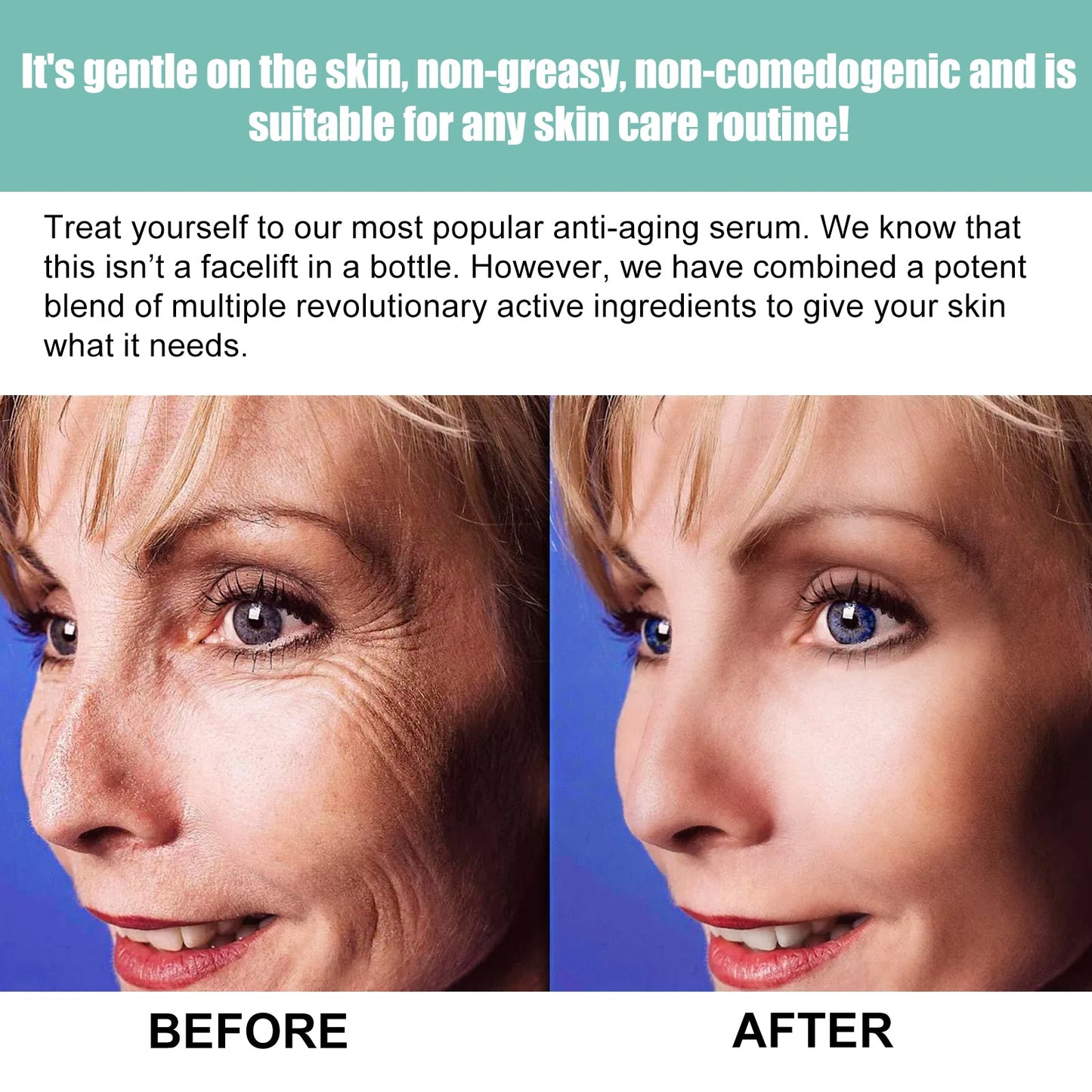 OUHOE This Facial Essence Is A Gentle, Moisturizing, Hydrating And Softening Daily Skin Care Essence For The Face
