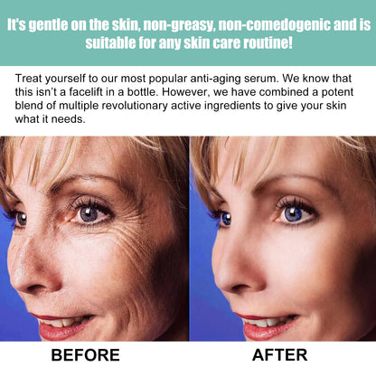 OUHOE This Facial Essence Is A Gentle, Moisturizing, Hydrating And Softening Daily Skin Care Essence For The Face