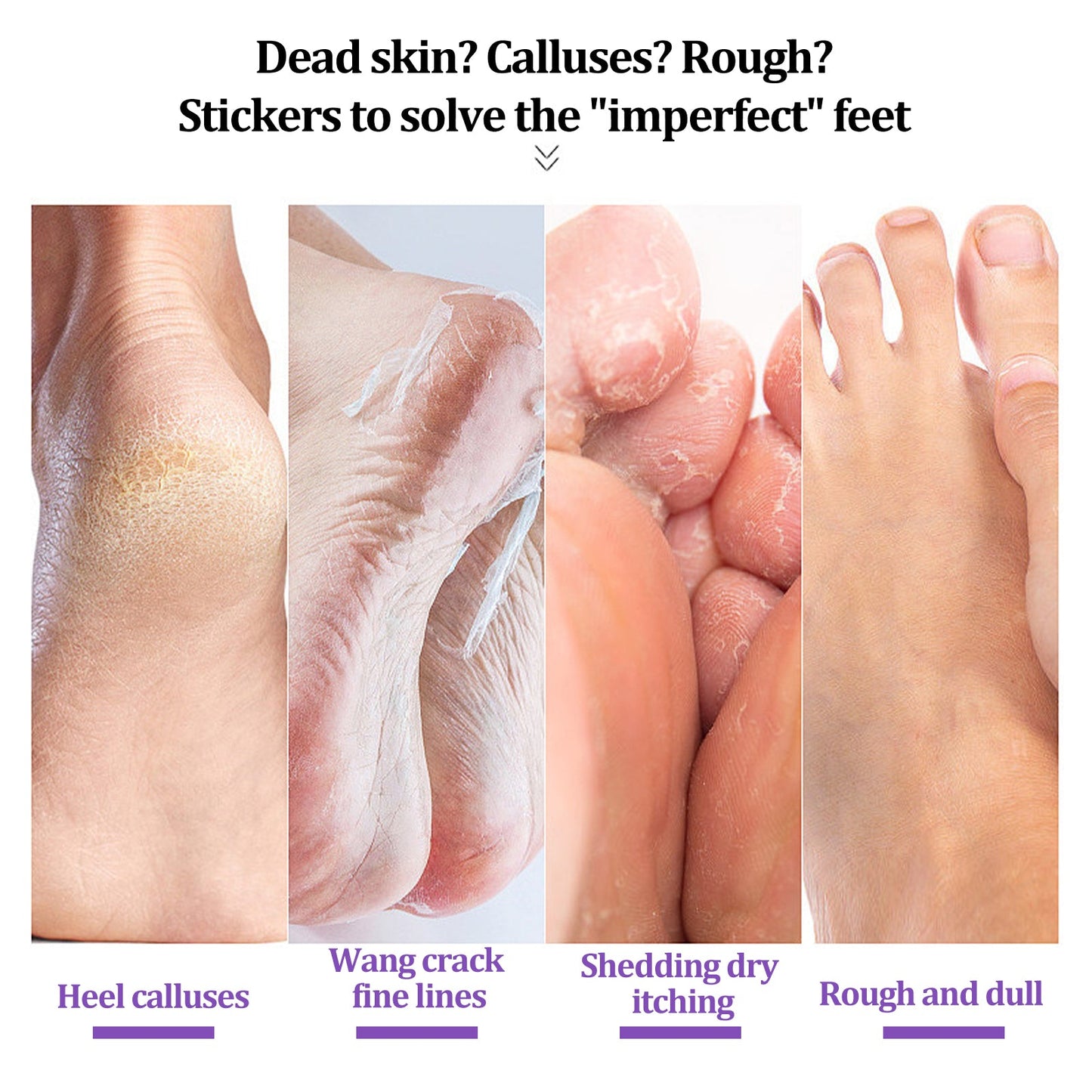 EELHOE Ginger Foot Mask (Bag) Foot Moisturizing, Nourishing, Rejuvenating, Exfoliating, Removing Dead Skin, Dry And Cracked Skin Care Foot Mask
