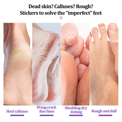 EELHOE Ginger Foot Mask (Bag) Foot Moisturizing, Nourishing, Rejuvenating, Exfoliating, Removing Dead Skin, Dry And Cracked Skin Care Foot Mask