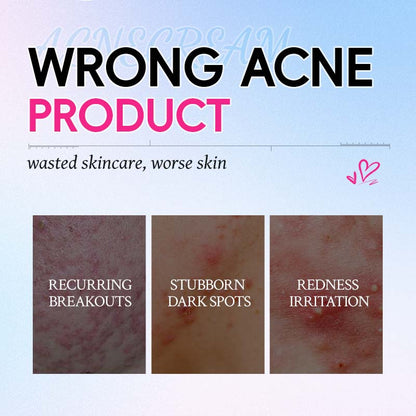 HUNMUI Anti-Acne Cream 7g