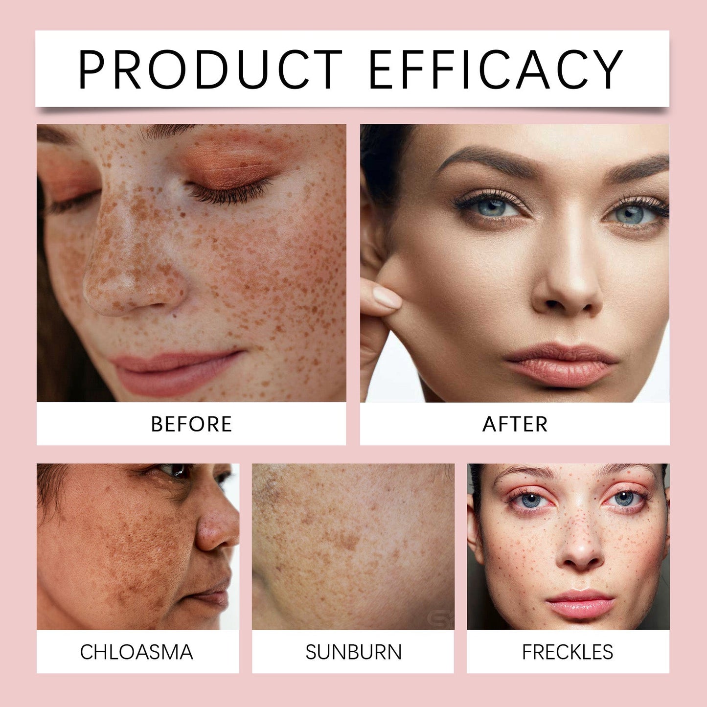 OUHOE Freckle Whitening Brightening Serum, Brightening And Firming Skin Plant Extract