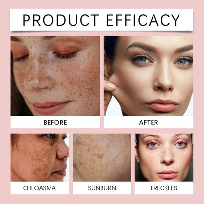 OUHOE Freckle Whitening Brightening Serum, Brightening And Firming Skin Plant Extract