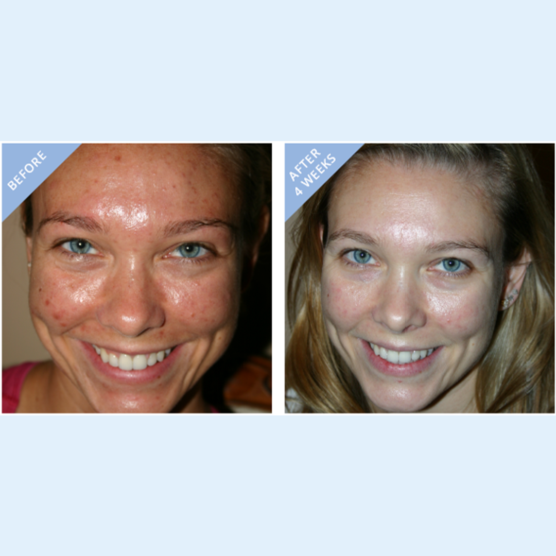 Daily Micro Derm Face and Body Scrub - as seen in Fab Fit Fun! - 6 oz 180 mL