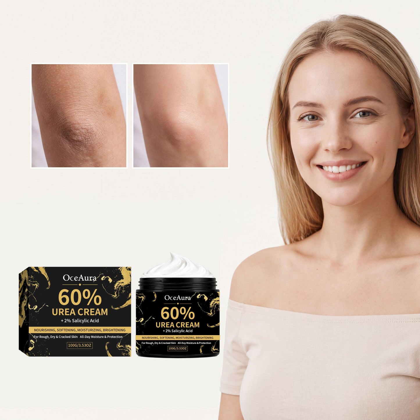 Urea Moisturizing Cream