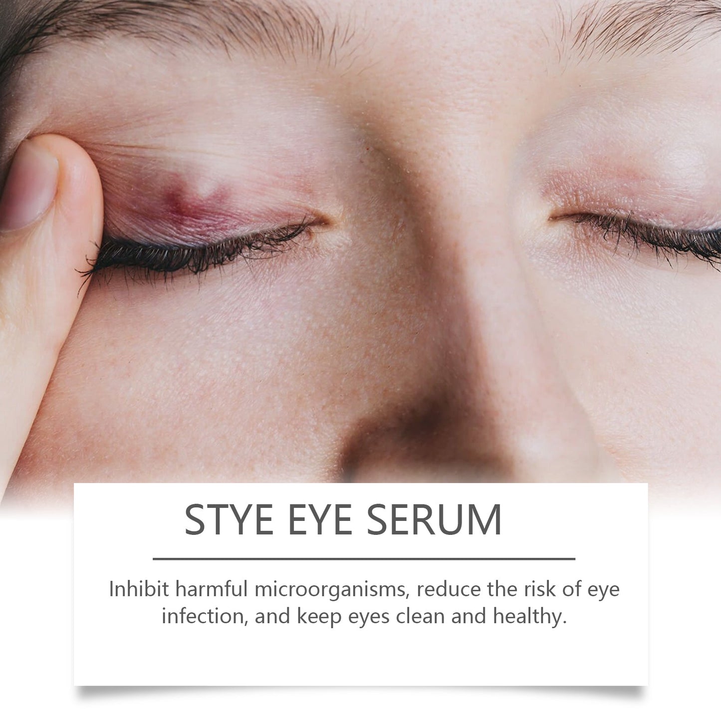 OUHOE Eye Care Drops Gently Nourish And Moisturize The Skin Around The Eyes. Portable Daily Eye Care Drops