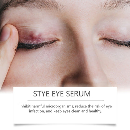 OUHOE Eye Care Drops Gently Nourish And Moisturize The Skin Around The Eyes. Portable Daily Eye Care Drops