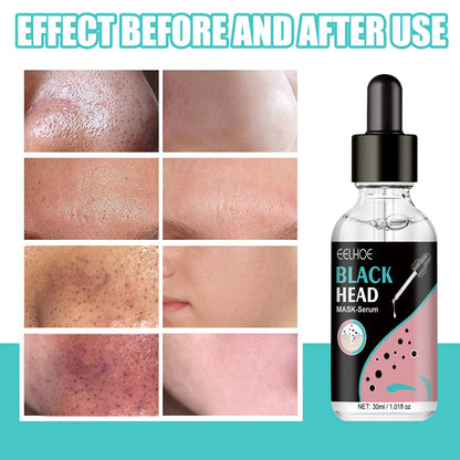 EELHOE Blackhead Nose Mask Moisturizes And Smoothes The Skin, Removes Blackheads From Acne And Deeply Cleans Pores And Dirt