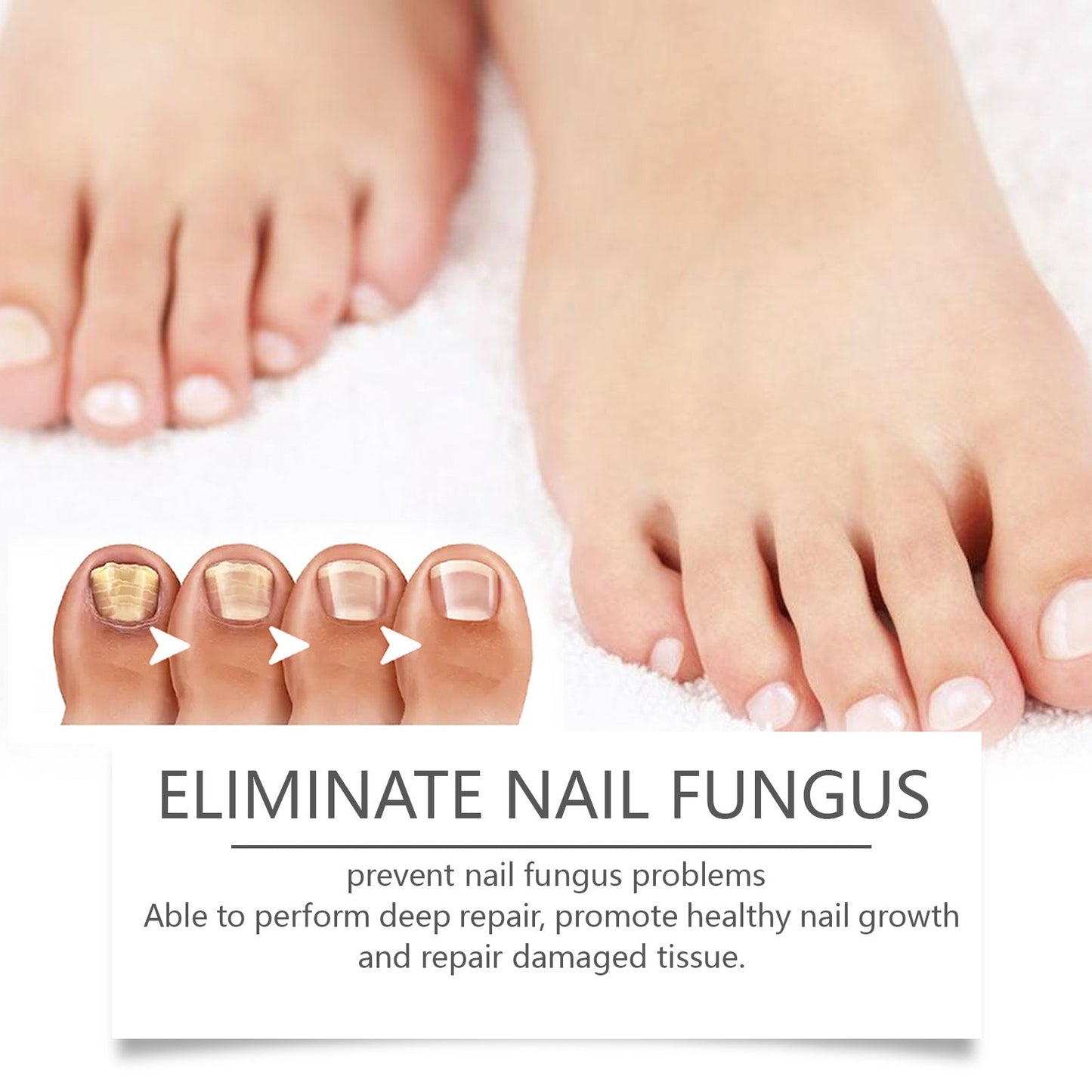 South Moon Nail Repair Pen Moisturizes Gently Repair Hands And Feet Gray Nails Soft Nails Thick Nails Foot Care