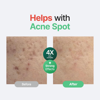 Wonder Releaf Centella Facial Serum