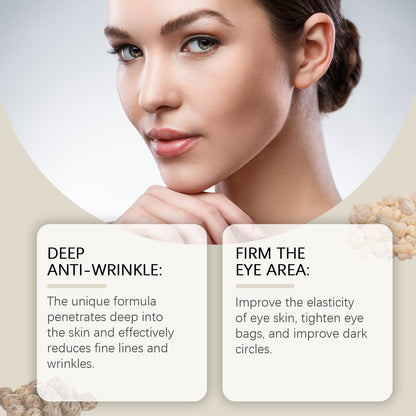 OUHOE Firming Eye Ball Essential Oil, Gentle Care Firming Eye Skin Moisturizing And Hydrating Eye Care