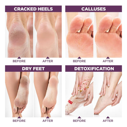 Lavender Bath Salt Exfoliator Foot Mask