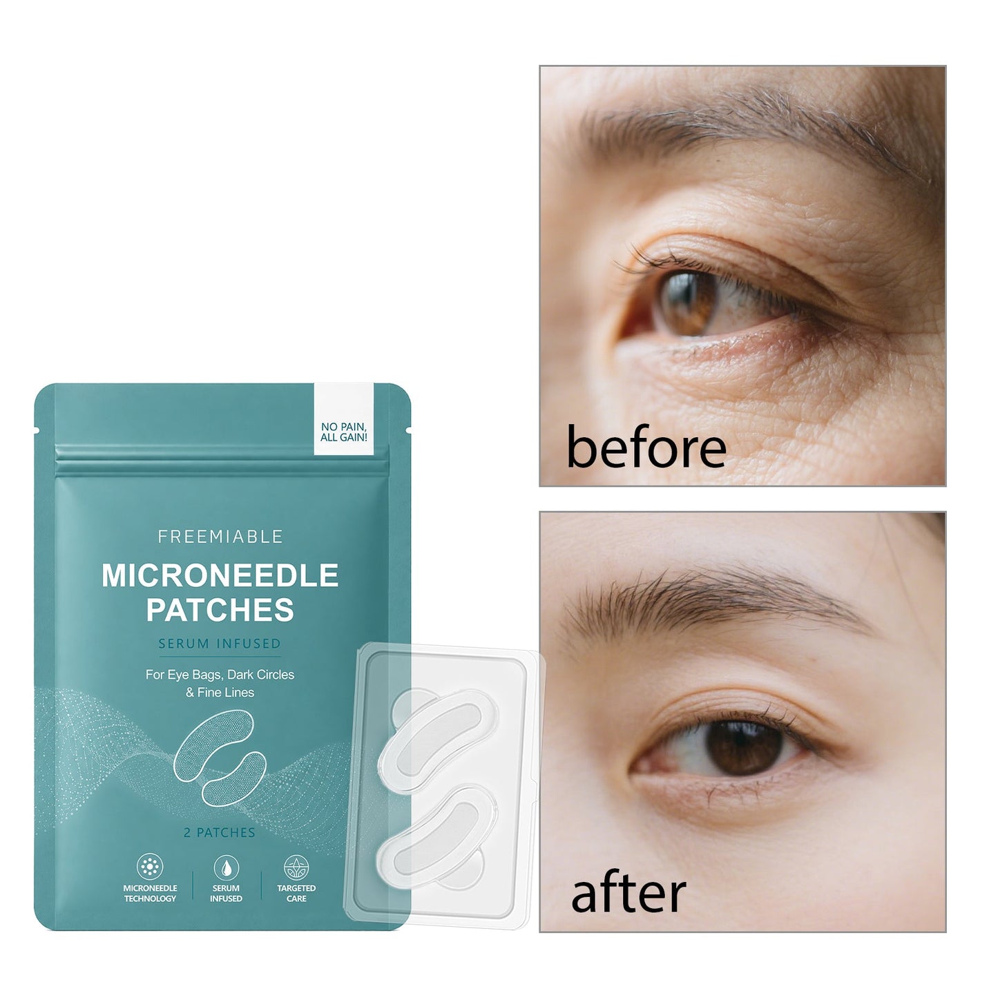 Eye Microneedle Patch 2pcs