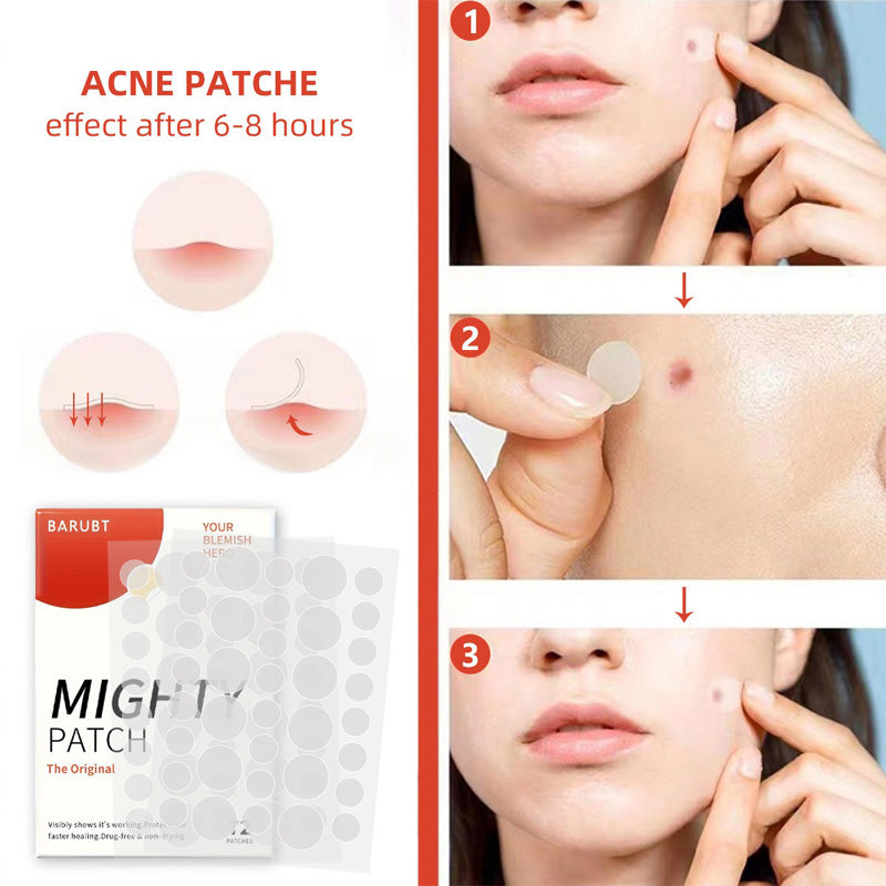 72 Count Acne Scar Patch,Nighttime Spot Stickers For Face And Skin,Shrinking Zits And Whiteheads