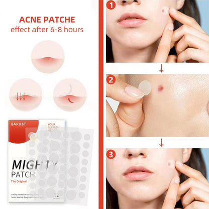 72 Count Acne Scar Patch,Nighttime Spot Stickers For Face And Skin,Shrinking Zits And Whiteheads