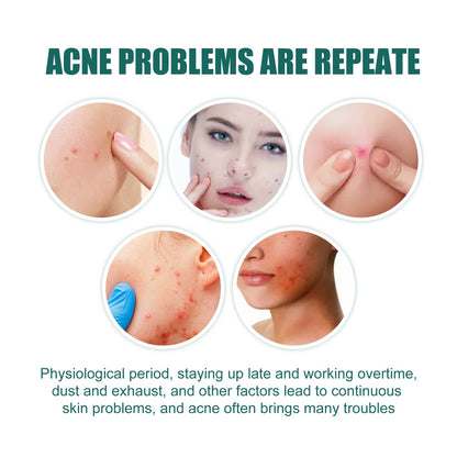 EELHOE Love Acne Patch Gentle Cleansing Acne Patch Fades Facial Acne Marks And Spots Facial Cleansing Care