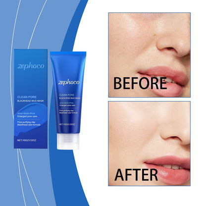 Blackhead Cleansing Mud Mask