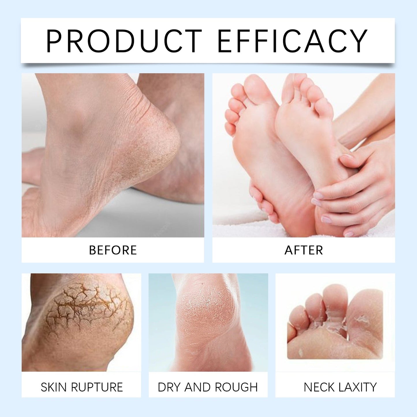 Urea Moisturizing Foot Repair Cream