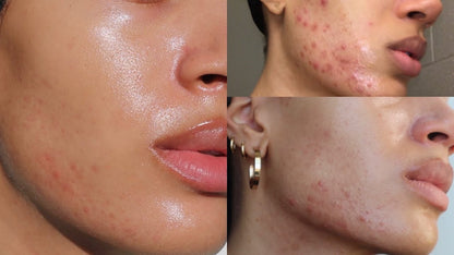 It Girl Skin – Ceramide, Hyaluronic Acid & Beauty Gummies for Glowing Skin
