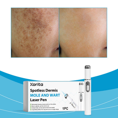 Skin Care Laser Pen 1pc