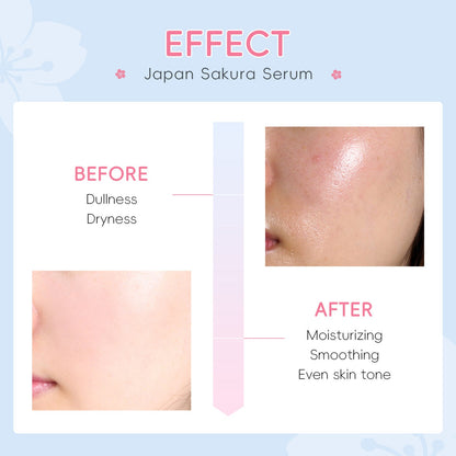 DR Japanese Cherry Blossom