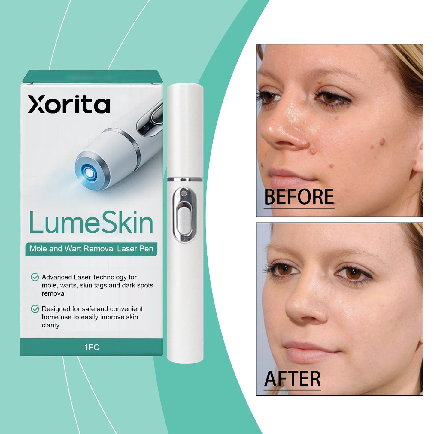 Skin Laser Pen 1pc