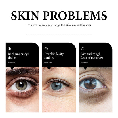 Wiyun Eye Cream: Gentle And Nourishing Care For The Skin Around The Eyes, Soft And Tender Skin Care, Hydrating Skin Care Eye Cream