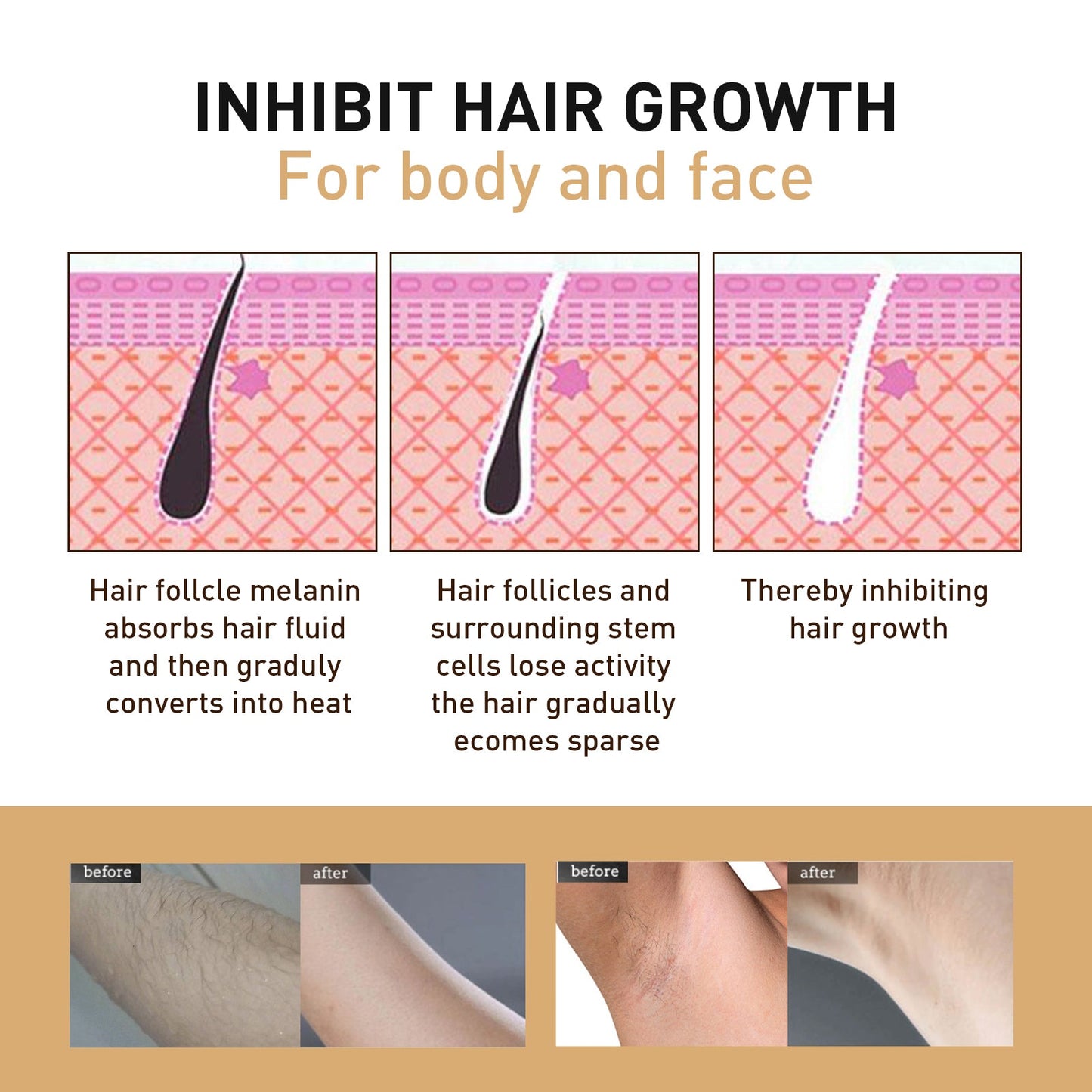 OUHOE Hair Removal Spray, Mild Non-Irritating Dry And Cool Whole Body Hair Removal And Hair Suppression Spray