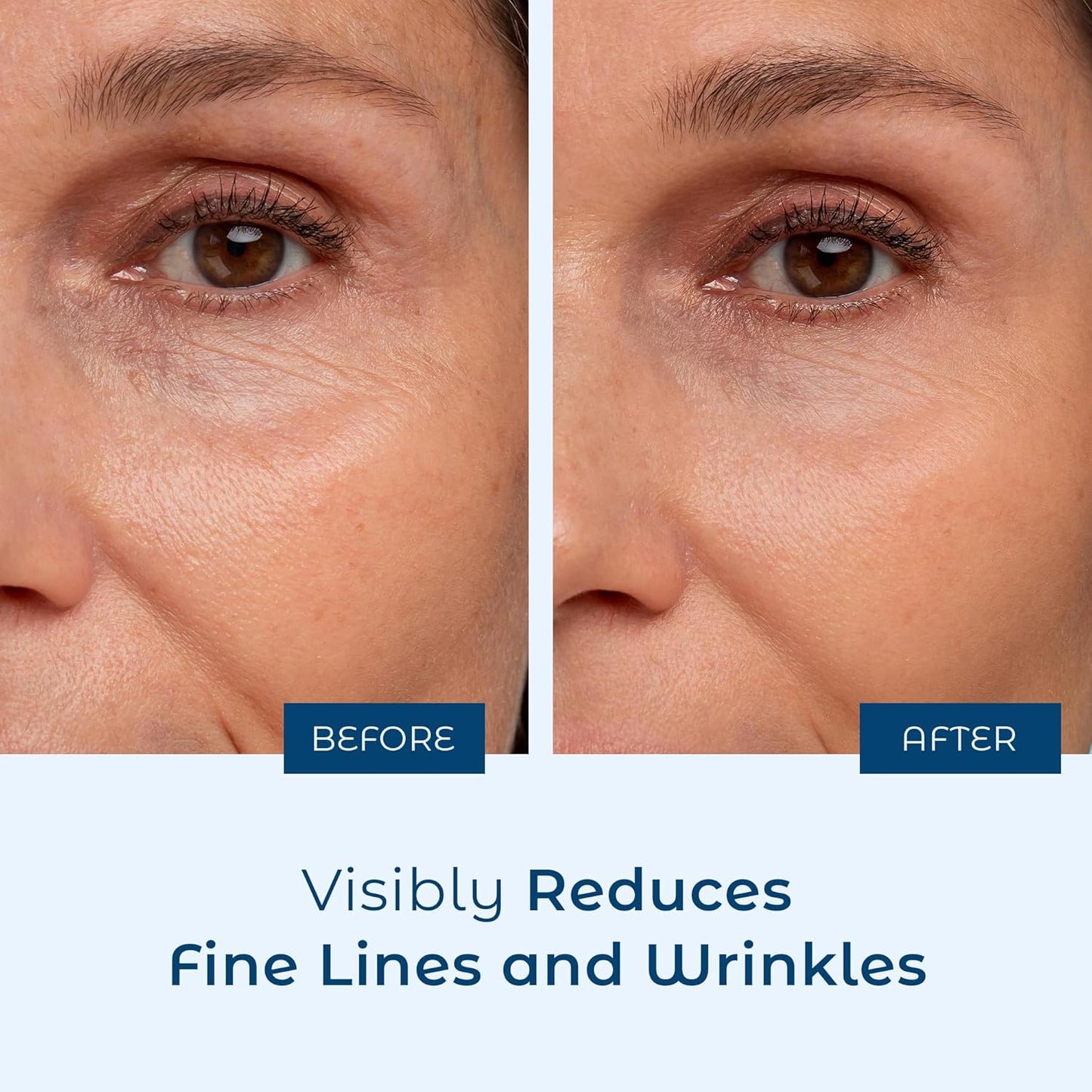 Pure Hyaluronic Acid Serum By Cosmedica Skincare