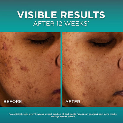 L'OREAL Bright Reveal Dark Spot Serum