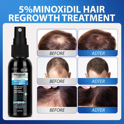 MINOXIDIL Hair And Beard Growth