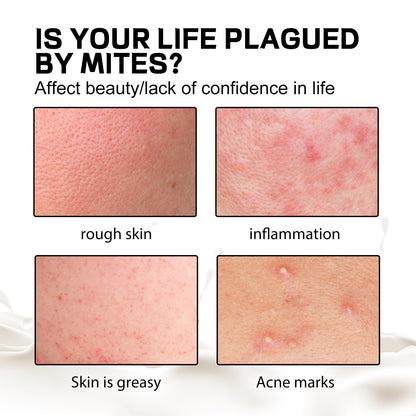 EELHOE Aurora Purifying Mite-Removing Soap, Deep Cleansing Facial Body Skin Fade Acne Print Multi-Effect Cleansing Soap