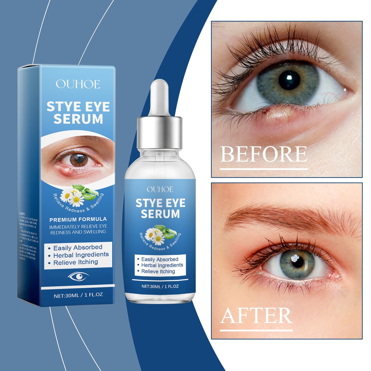 OUHOE Eye Care Drops Gently Nourish And Moisturize The Skin Around The Eyes. Portable Daily Eye Care Drops