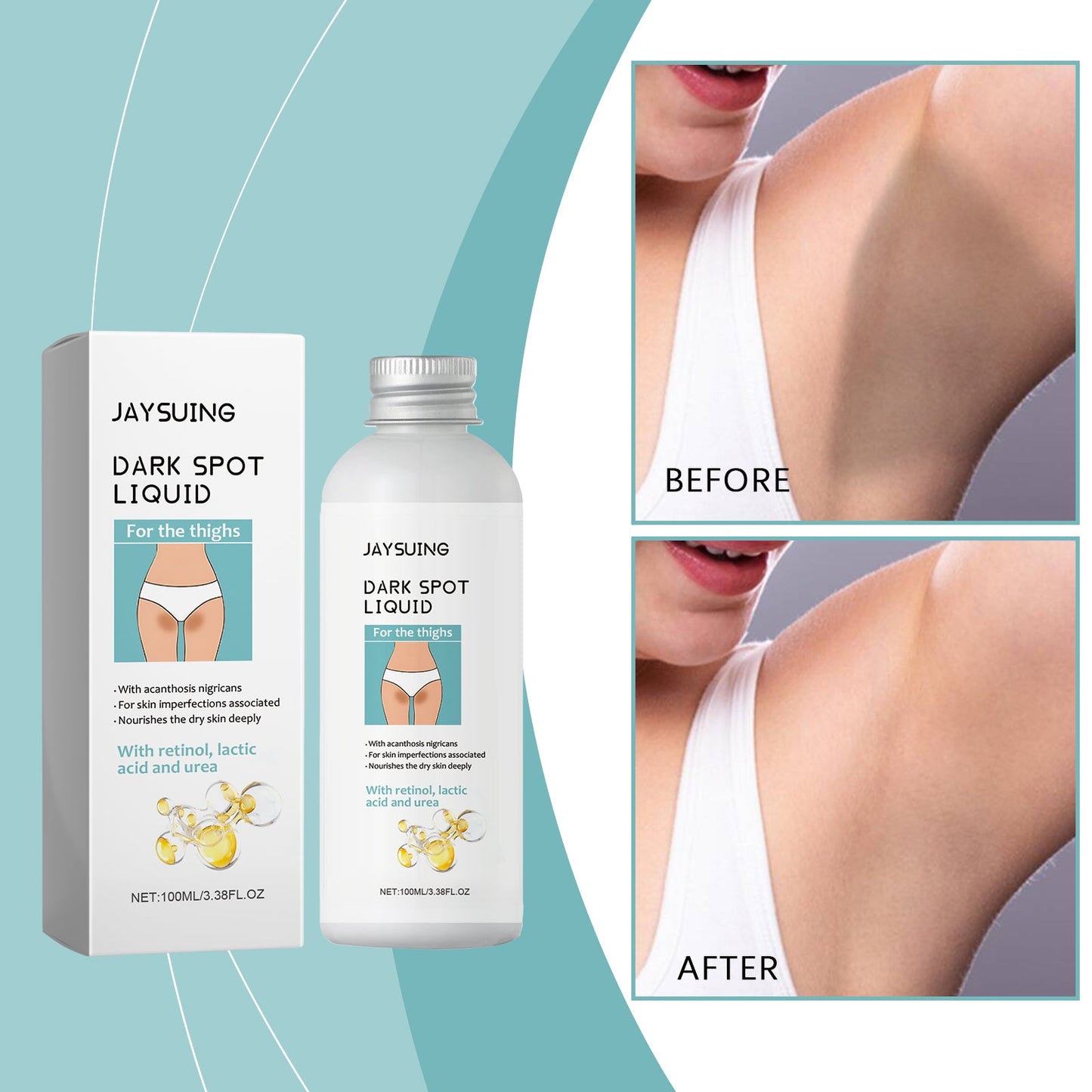 Jaysuing Leg Beauty Lotion, Inner Thigh Moisturizing And Moisturizing Leg Nourishing Body Lotion