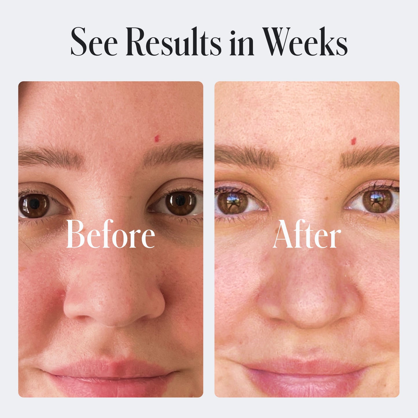 Skin Repair Moisturizer