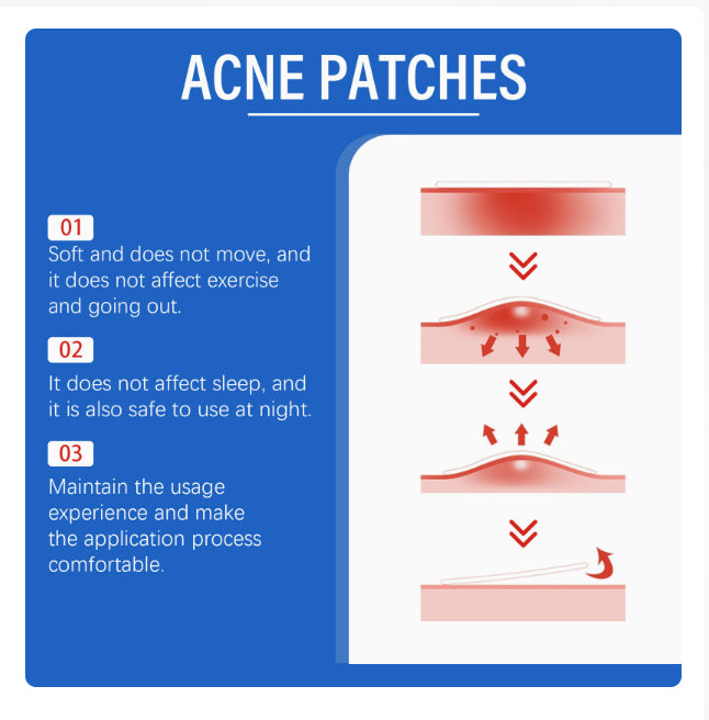 Acne Patches