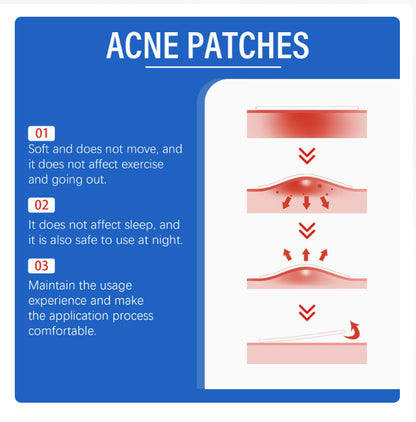 Acne Patches