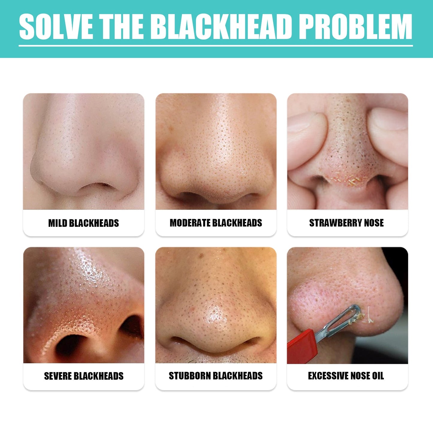 EELHOE Blackhead Nose Mask Moisturizes And Smoothes The Skin, Removes Blackheads From Acne And Deeply Cleans Pores And Dirt