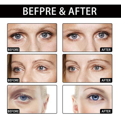 Hoygi Coconut Eye Gel Patch Reduces Fine Lines Under Eyes, Dark Circles Under Eyes, Firming Eyes, Anti-Wrinkle Moisturizing Eye Patch