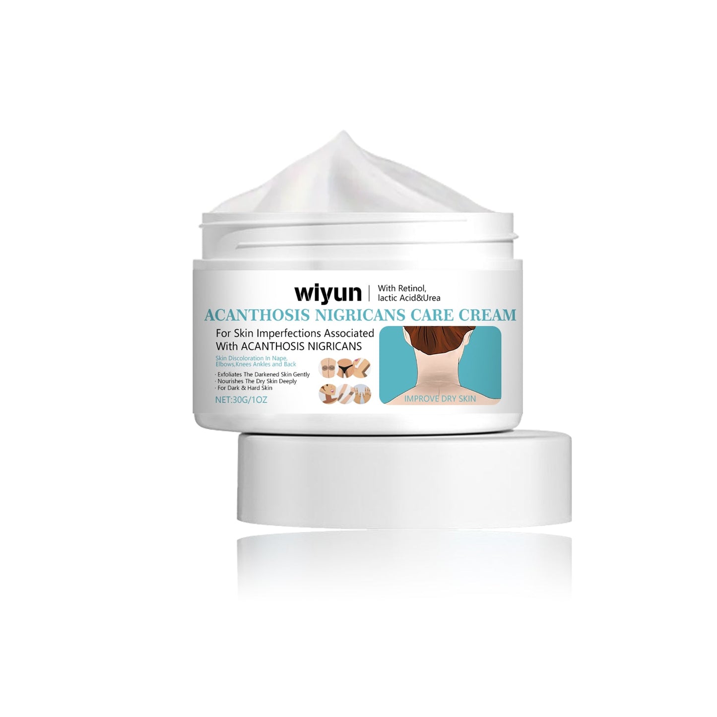 Wiyun Acanthoderma Nigricans Care Cream Soft Moist, Hydrating, Refreshing And Improving Dry And Tender Skin Body Care Cream