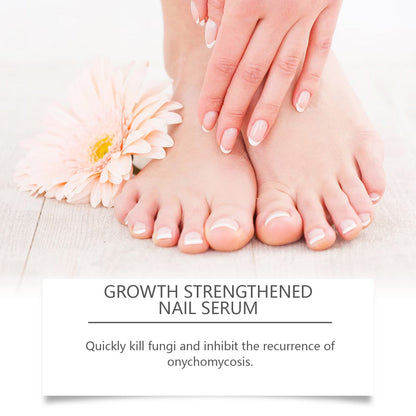 South Moon Nail Care Essence Gently Cleanses The Keratin Layer Of Nails On Hands And Feet. Brightening Nail Care Liquid